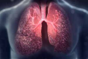 Fibroza chistică – Cauze, simptome, factori de risc, tratament