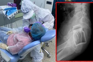 UN BOTOȘĂNEAN A AJUNS LA URGENȚE CU UN BORCAN ÎN.. ANUS! MEDICII ȘI-AU FĂCUT CRUCE CÂND AU AFLAT CINE E, DE FAPT, BĂRBATUL ȘI DE CE ȘI-A BĂGAT BORCANUL ACOLO