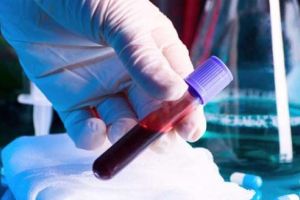 Sub 100 din cei circa 12.000 de români vindecaţi de Covid-19 au donat plasmă convalescentă