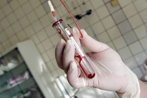 Nelu Tătaru: ,,Testarea naţională se va realiza pe eşantioane cu serul rezidual al pacienţilor care vin la laboratoarele din judeţe pentru a-şi face diverse analize”