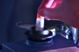 Încă o bihoreancă infectată cu coronavirus a murit