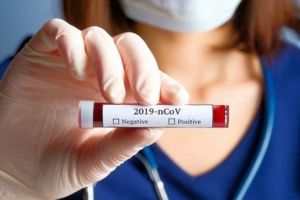 OFICIAL| 124 NOI cazuri de COVID-19 în România. Bilanţul total urcă la 19.257 de îmbolnăviri şi 1262 de decese