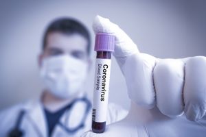 01.06.2020 752 de cazuri de infectare cu noul coronavirus, la Braşov! 19.398 la nivel naţional
