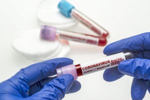Comisia Europeană a confirmat ă noul coronavirus nu este atât de periculos: Reprezintă doar un risc de nivel mediu pentru lucrători