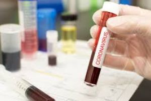 Astazi, cele mai multe cazuri de coronavirus confirmate de la relaxarea restrictiilor / Avertizarea specialistilor