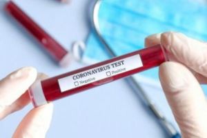OFICIAL| România trece pragul de 20.000 de infectări cu COVID-19: 196 NOI cazuri confirmate în ultimele 24 de ore