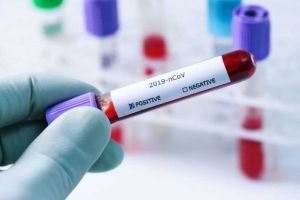 OFICIAL: 189 cazuri noi de coronavirus în România. Bilanţul total ajunge la 20.479 de imbolnăviri