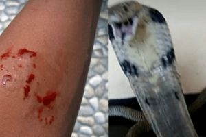 Ce nebunie! Un tanar a fost muscat de propria cobra insa in loc sa sune la salvare si-a postat imaginile pe Facebook