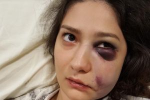 Bătaie în pasajul Vulturul Negru: O tânără a ajuns la spital, bătută de doi bărbaţi pe care ea şi prietena ei i-au refuzat (FOTO)