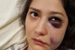 SCANDAL la Oradea. Tânără BĂTUTĂ pentru că a REFUZAT AVANSURILE unor bărbaţi, într-un club