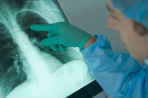 Alertă la Şcoala “Mihai Eminescu” din Roşiorii de Vede – 12 elevi depistaţi cu TBC