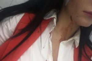 Cluj: Cântăreaţa Roberta Opre, bătută de grup de luptători MMA