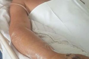 Barbatul ranit in accidentul de pe autostrada Timisoara-Deva are nevoie de ajutorul vostru