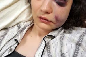 Chef... de pumni: De la cine a pornit bătaia în urma căreia o orădeancă a ajuns cu ochiul învineţit la spital?