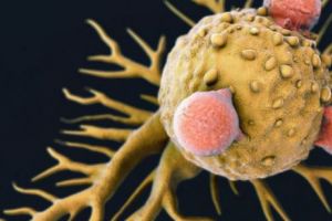 PAS URIAȘ spre VINDECAREA CANCERULUI. Cumplita boală, DEPISTATĂ LA TIMP cu un test de sânge. BREAKING NEWS în MEDICINA MONDIALĂ