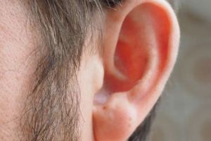 Cum se elimină dopul de ceară fără a leza timpanul 