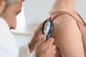 Depigmentarea pielii cauze, simptome si metode de tinere sub control a afectiunii