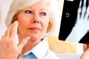 TRATAMENTUL pentru artrită care va REVOLUȚIONA medicina. Milioane de oameni ar putea fi AJUTAȚI