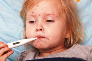 Epidemia de rujeolă nu dă semne de oboseală