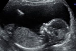 Secta „Templul Satanic” a învins statul Missouri invocând DREPTURILE SATANIȘTILOR